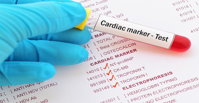 cardiac-troponin.jpg