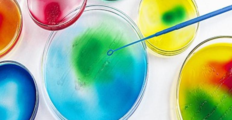 multi colored petri dishes